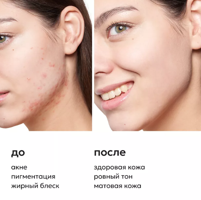 Сыворотка для лица Likato Professional с ниацинамидом и цинком 30мл