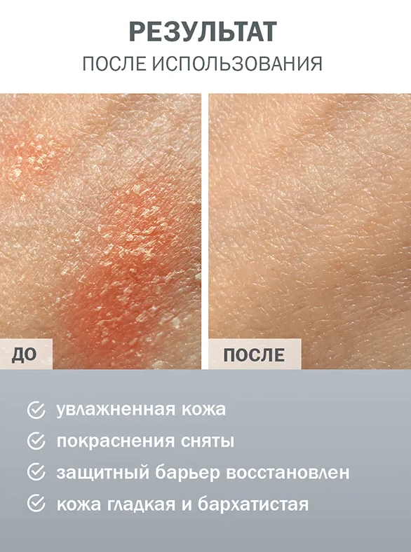 Молочко для тела Фельдшер увлажняющее с пантенолом 190мл - в интернет-магазине tut-beauty.by