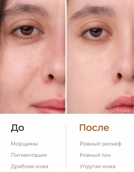 Сыворотка для лица Likato Professional с лифтинг-эффектом 30мл