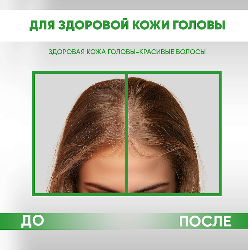 Пилинг для кожи головы EDEN 100мл - в интернет-магазине tut-beauty.by