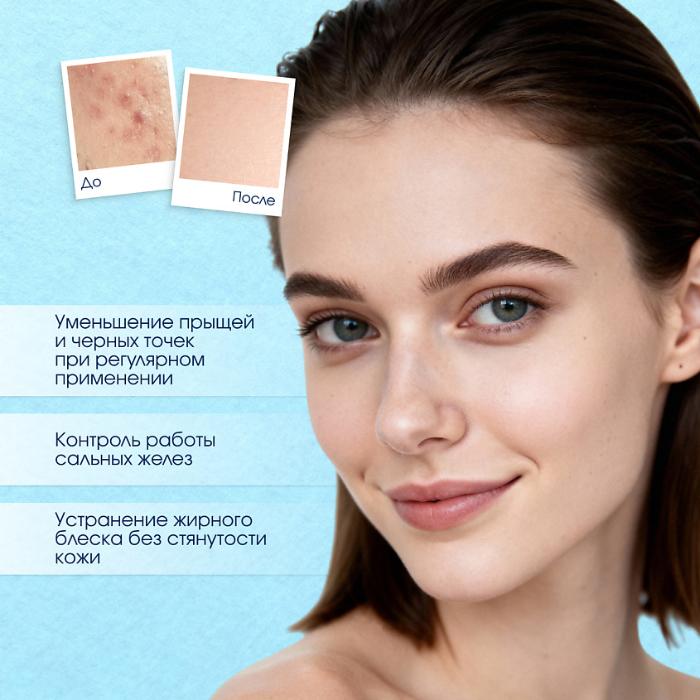 Гель для умывания Stopproblem Intensive Therapy салициловый 100мл - в интернет-магазине tut-beauty.by