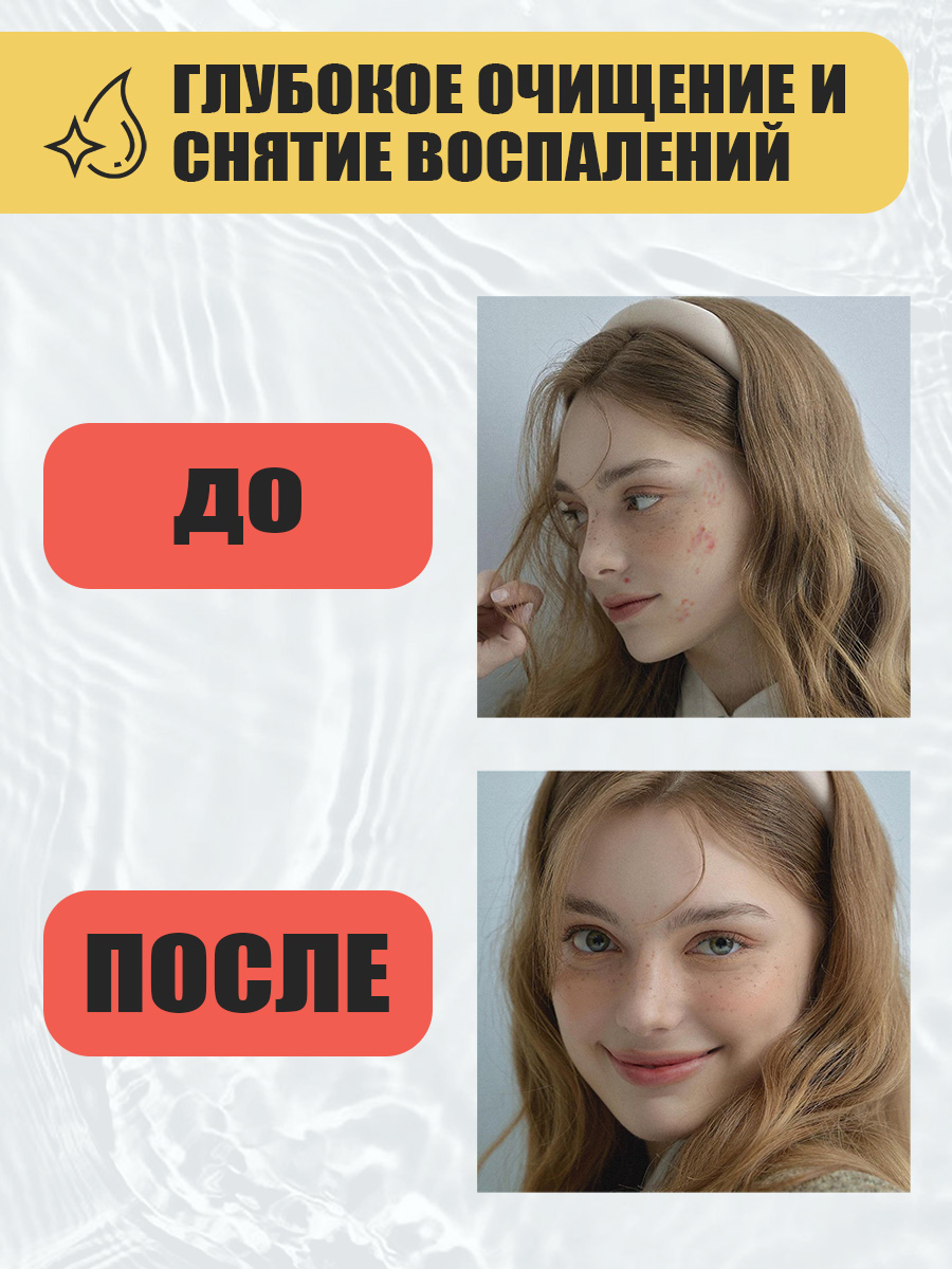Тоник для лица Eden Stop Acne от прыщей 150мл
