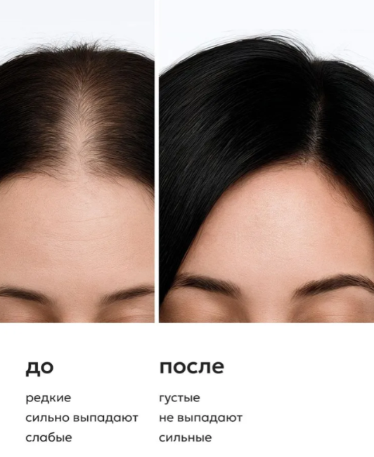 Тоник для волос Likato Professional для роста волос с розмарином 150мл