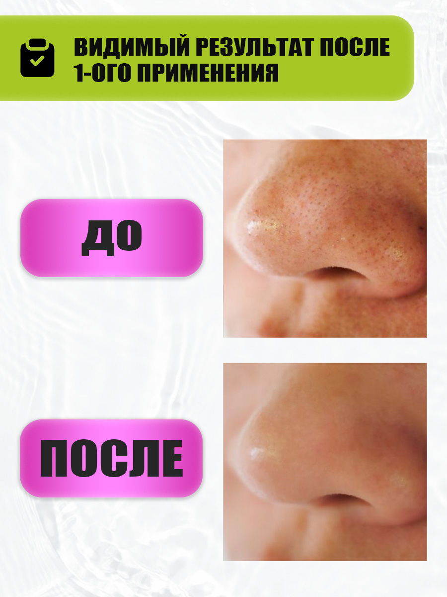 Скраб для лица Eden Stop Acne содовый от прыщей 75мл - в интернет-магазине tut-beauty.by